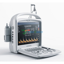 Ecografía Doppler digital de diagnóstico